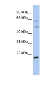PSMC2 / RPT1 Antibody - PSMC2 antibody Western blot of OVCAR-3 cell lysate. This image was taken for the unconjugated form of this product. Other forms have not been tested.