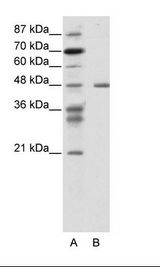PSMC2 / RPT1 Antibody - A: Marker, B: Jurkat Cell Lysate.  This image was taken for the unconjugated form of this product. Other forms have not been tested.