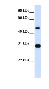 PSMC3 Antibody - PSMC3 antibody Western blot of Placenta lysate. This image was taken for the unconjugated form of this product. Other forms have not been tested.