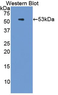 PSMC3 Antibody - Western blot of recombinant PSMC3 / Rpt5.