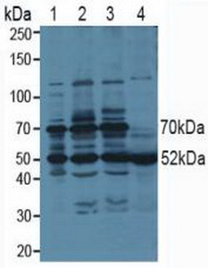 PSMC3 Antibody - Western Blot; Lane1: Human 293T cells; Lane2: Human Hela Cells; Lane3: Human HepG2 cells; Lane4: Human Saliva Tissue.