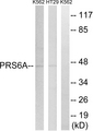 PSMC3 Antibody - Western blot analysis of lysates from K562 and HT-29 cells, using PRS6A Antibody. The lane on the right is blocked with the synthesized peptide.