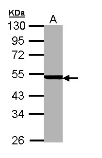 PSMC3 Antibody - Sample (30 ug of whole cell lysate). A: MOLT4 . 10% SDS PAGE. TBP-1 / Rpt5 antibody diluted at 1:5000