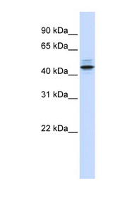 PSMC3 Antibody - PSMC3 antibody Western blot of Fetal Lung lysate. This image was taken for the unconjugated form of this product. Other forms have not been tested.