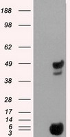 PSMC3 Antibody - HEK293T cells were transfected with the pCMV6-ENTRY control (Left lane) or pCMV6-ENTRY PSMC3 (Right lane) cDNA for 48 hrs and lysed. Equivalent amounts of cell lysates (5 ug per lane) were separated by SDS-PAGE and immunoblotted with anti-PSMC3.