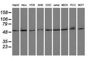 PSMC3 Antibody - Western blot of extracts (35 ug) from 9 different cell lines by using anti-PSMC3 monoclonal antibody.