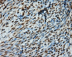 PSMC3 Antibody - IHC of paraffin-embedded endometrium tissue using anti-PSMC3 mouse monoclonal antibody. (Dilution 1:50).