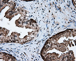 PSMC3 Antibody - IHC of paraffin-embedded prostate tissue using anti-PSMC3 mouse monoclonal antibody. (Dilution 1:50).