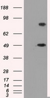 PSMC3 Antibody - HEK293T cells were transfected with the pCMV6-ENTRY control (Left lane) or pCMV6-ENTRY PSMC3 (Right lane) cDNA for 48 hrs and lysed. Equivalent amounts of cell lysates (5 ug per lane) were separated by SDS-PAGE and immunoblotted with anti-PSMC3.