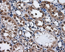 PSMC3 Antibody - IHC of paraffin-embedded Kidney tissue using anti-PSMC3 mouse monoclonal antibody. (Dilution 1:50).