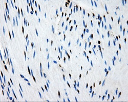 PSMC3 Antibody - Immunohistochemical staining of paraffin-embedded colon tissue using anti-PSMC3 mouse monoclonal antibody. (Dilution 1:50).