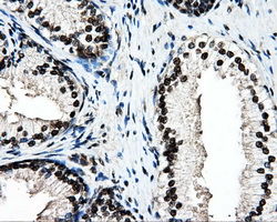 PSMC3 Antibody - Immunohistochemical staining of paraffin-embedded prostate tissue using anti-PSMC3 mouse monoclonal antibody. (Dilution 1:50).