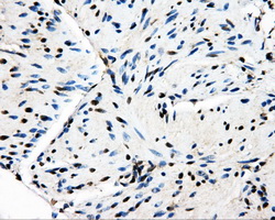 PSMC3 Antibody - Immunohistochemical staining of paraffin-embedded bladder tissue using anti-PSMC3 mouse monoclonal antibody. (Dilution 1:50).