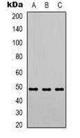 PSMC3 Antibody - Western blot analysis of PSMC3 expression in HeLa (A); HepG2 (B); HT29 (C) whole cell lysates.