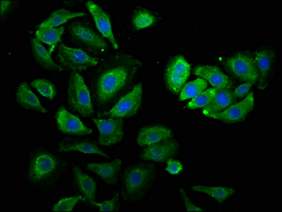PSMC3 Antibody - Immunofluorescence staining of A549 cells with PSMC3 Antibody at 1:530, counter-stained with DAPI. The cells were fixed in 4% formaldehyde, permeabilized using 0.2% Triton X-100 and blocked in 10% normal Goat Serum. The cells were then incubated with the antibody overnight at 4°C. The secondary antibody was Alexa Fluor 488-congugated AffiniPure Goat Anti-Rabbit IgG(H+L).