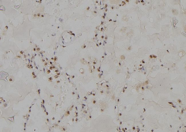 PSMC3 Antibody - 1:100 staining human lung tissue by IHC-P. The sample was formaldehyde fixed and a heat mediated antigen retrieval step in citrate buffer was performed. The sample was then blocked and incubated with the antibody for 1.5 hours at 22°C. An HRP conjugated goat anti-rabbit antibody was used as the secondary.