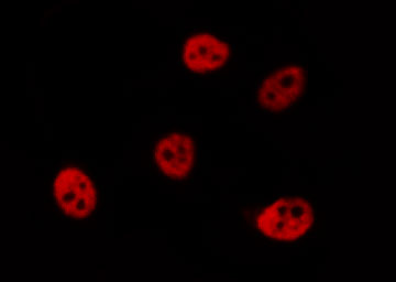 PSMC3 Antibody - Staining HeLa cells by IF/ICC. The samples were fixed with PFA and permeabilized in 0.1% Triton X-100, then blocked in 10% serum for 45 min at 25°C. The primary antibody was diluted at 1:200 and incubated with the sample for 1 hour at 37°C. An Alexa Fluor 594 conjugated goat anti-rabbit IgG (H+L) antibody, diluted at 1/600, was used as secondary antibody.