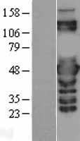 PSMC3 Protein - Western validation with an anti-DDK antibody * L: Control HEK293 lysate R: Over-expression lysate