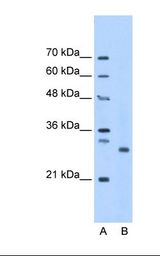 PSMC3IP Antibody - Lane A: Marker. Lane B: HepG2 cell lysate. Antibody concentration: 1.25 ug/ml. Gel concentration: 12%.  This image was taken for the unconjugated form of this product. Other forms have not been tested.