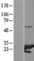 PSMC3IP Protein - Western validation with an anti-DDK antibody * L: Control HEK293 lysate R: Over-expression lysate
