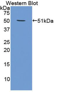 PSMC4 Antibody - Western blot of recombinant PSMC4 / TBP7.