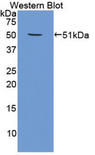 PSMC4 Antibody - Western blot of recombinant PSMC4 / TBP7.