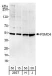 PSMC4 Antibody - Detection of Human PSMC4 by Western Blot. Samples: Whole cell lysate from 293T (15 and 50 ug), HeLa (H; 50 ug), and Jurkat (J; 50 ug) cells. Antibodies: Affinity purified rabbit anti-PSMC4 antibody used for WB at 0.4 ug/ml. Detection: Chemiluminescence with an exposure time of 30 seconds.