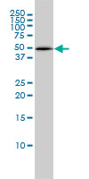 PSMC4 Antibody - PSMC4 monoclonal antibody (M01), clone 3G8 Western blot of PSMC4 expression in HepG2.