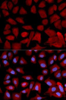 PSMC4 Antibody - Immunofluorescence analysis of U2OS cells.