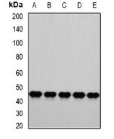 PSMC4 Antibody - Western blot analysis of PSMC4 expression in HepG2 (A); A549 (B); HeLa (C); Jurkat (D); mouse liver (E) whole cell lysates.