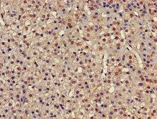 PSMC4 Antibody - Immunohistochemistry Dilution at 1:500 and staining in paraffin-embedded human adrenal gland tissue performed on a Leica BondTM system. After dewaxing and hydration, antigen retrieval was mediated by high pressure in a citrate buffer (pH 6.0). Section was blocked with 10% normal Goat serum 30min at RT. Then primary antibody (1% BSA) was incubated at 4°C overnight. The primary is detected by a biotinylated Secondary antibody and visualized using an HRP conjugated SP system.