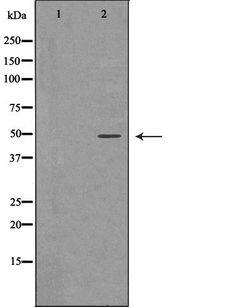 PSMC4 Antibody - Western blot analysis of HeLa whole cells lysates using PSMC4 antibody. The lane on the left is treated with the antigen-specific peptide.