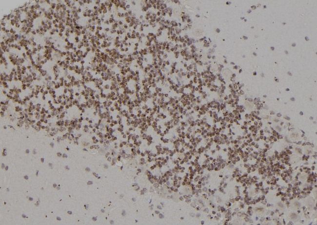 PSMC4 Antibody - 1:100 staining rat brain tissue by IHC-P. The sample was formaldehyde fixed and a heat mediated antigen retrieval step in citrate buffer was performed. The sample was then blocked and incubated with the antibody for 1.5 hours at 22°C. An HRP conjugated goat anti-rabbit antibody was used as the secondary.