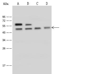 PSMC4 Antibody - Anti-PSMC4 rabbit polyclonal antibody at 1:500 dilution. Lane A: HepG2 Whole Cell Lysate. Lane B: Jurkat Whole Cell Lysate. Lane C: 293T Whole Cell Lysate. Lane D: A549 Whole Cell Lysate. Lysates/proteins at 30 ug per lane. Secondary: Goat Anti-Rabbit IgG (H+L)/HRP at 1/10000 dilution. Developed using the ECL technique. Performed under reducing conditions. Predicted band size: 47 kDa.