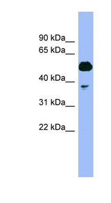 PSMC4 Antibody - PSMC4 / TBP7 antibody Western blot of Fetal Muscle lysate. This image was taken for the unconjugated form of this product. Other forms have not been tested.