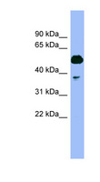 PSMC4 Antibody - PSMC4 / TBP7 antibody Western blot of Fetal Muscle lysate. This image was taken for the unconjugated form of this product. Other forms have not been tested.