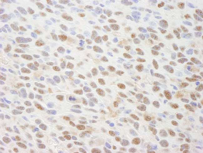 PSMC5 / SUG1 Antibody - Detection of Mouse TRIP1/SUG1 by Immunohistochemistry. Sample: FFPE section of mouse squamous cell carcinoma. Antibody: Affinity purified rabbit anti-TRIP1/SUG1 used at a dilution of 1:250.