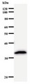 PSMC5 / SUG1 Antibody - Western blot of immunized recombinant protein using PSMC5 antibody.