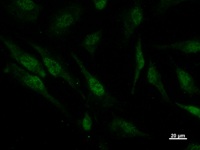 PSMC5 / SUG1 Antibody - Immunostaining analysis in HeLa cells. HeLa cells were fixed with 4% paraformaldehyde and permeabilized with 0.1% Triton X-100 in PBS. The cells were immunostained with anti-PSMC5 mAb.