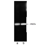 PSMC5 / SUG1 Antibody - Western blot of Proteasome 19S ATPase subunit Rpt6monoclonal antibody (p45-110). Antibody dilution 1:1000 (lane a) and 1:5000 (lane b) using ECL procedure.