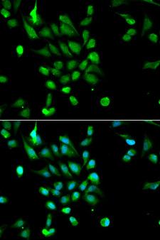 PSMC5 / SUG1 Antibody - Immunofluorescence analysis of MCF-7 cells using PSMC5 antibody. Blue: DAPI for nuclear staining.