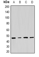 PSMC5 / SUG1 Antibody - Western blot analysis of PSMC5 expression in HepG2 (A); MCF7 (B); NIH3T3 (C); PC12 (D) whole cell lysates.