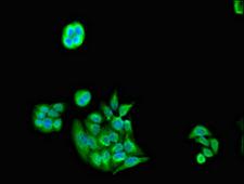 PSMC5 / SUG1 Antibody - Immunofluorescent analysis of PC3 cells diluted at 1:100 and Alexa Fluor 488-congugated AffiniPure Goat Anti-Rabbit IgG(H+L)