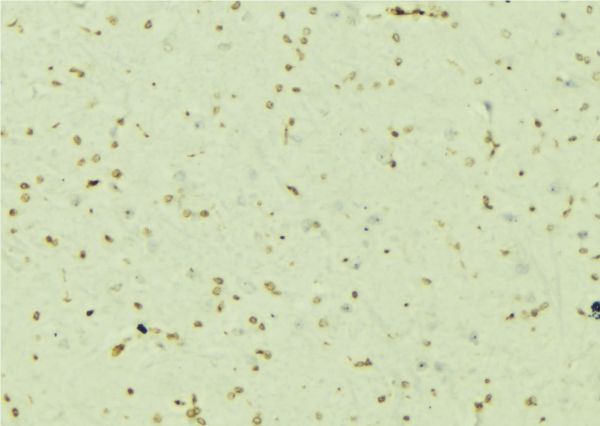 PSMC5 / SUG1 Antibody - 1:100 staining mouse brain tissue by IHC-P. The sample was formaldehyde fixed and a heat mediated antigen retrieval step in citrate buffer was performed. The sample was then blocked and incubated with the antibody for 1.5 hours at 22°C. An HRP conjugated goat anti-rabbit antibody was used as the secondary.
