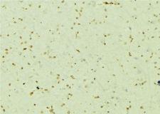 PSMC5 / SUG1 Antibody - 1:100 staining mouse brain tissue by IHC-P. The sample was formaldehyde fixed and a heat mediated antigen retrieval step in citrate buffer was performed. The sample was then blocked and incubated with the antibody for 1.5 hours at 22°C. An HRP conjugated goat anti-rabbit antibody was used as the secondary.