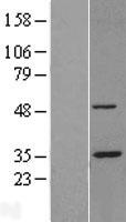 PSMC5 / SUG1 Protein - Western validation with an anti-DDK antibody * L: Control HEK293 lysate R: Over-expression lysate