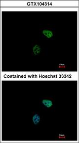 PSMC6 Antibody - Immunofluorescence of paraformaldehyde-fixed HeLa using PSMC6 antibody at 1:500 dilution.