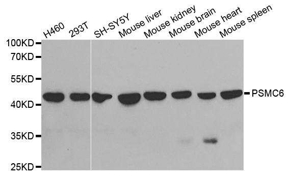 PSMC6 Antibody - Western blot analysis of extracts of various cell lines.