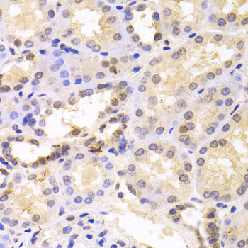 PSMC6 Antibody - Immunohistochemistry of paraffin-embedded human kidney tissue.