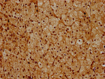PSMC6 Antibody - IHC image of PSMC6 Antibody diluted at 1:600 and staining in paraffin-embedded human adrenal gland tissue performed on a Leica BondTM system. After dewaxing and hydration, antigen retrieval was mediated by high pressure in a citrate buffer (pH 6.0). Section was blocked with 10% normal goat serum 30min at RT. Then primary antibody (1% BSA) was incubated at 4°C overnight. The primary is detected by a biotinylated secondary antibody and visualized using an HRP conjugated SP system.